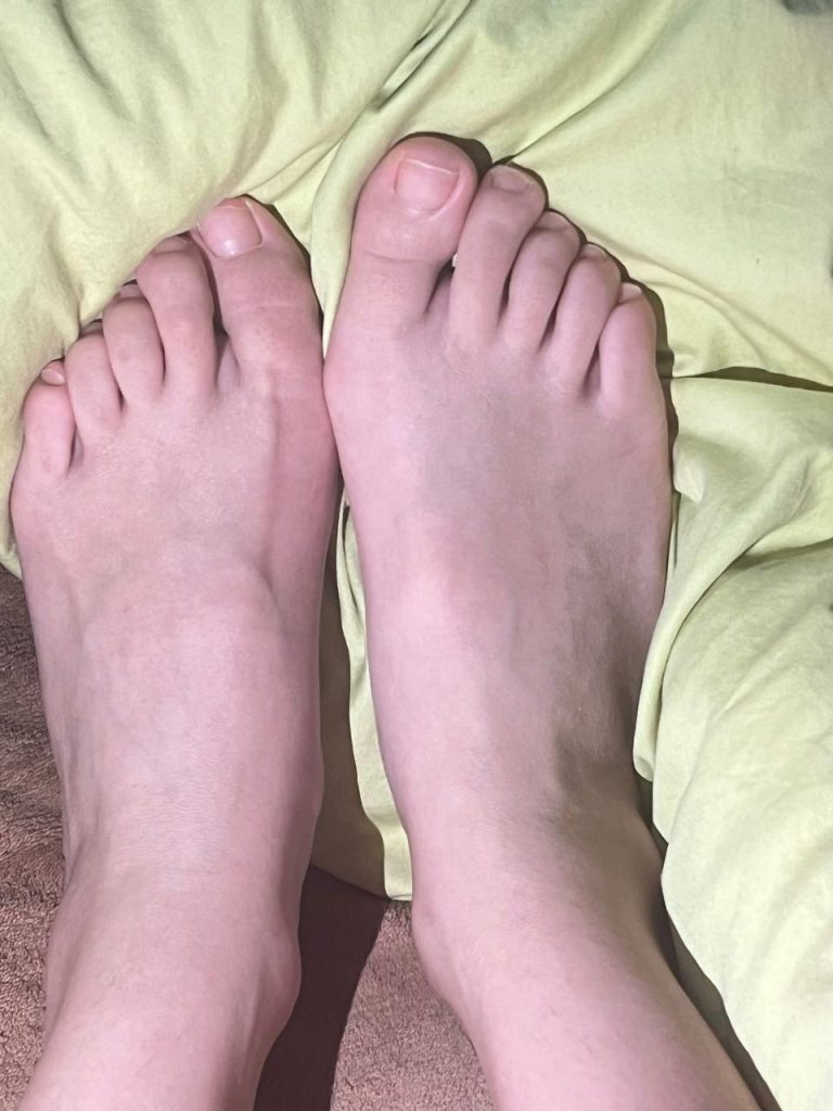 腳模面試臉足同框套路系列-078-高顏值紅白腳[4P/5V/71MB]插圖